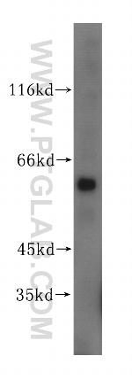PGS1 Antibody in Western Blot (WB)