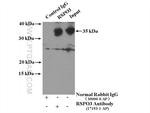RSPO3 Antibody in Immunoprecipitation (IP)