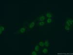 SKAR Antibody in Immunocytochemistry (ICC/IF)