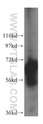 TRIM29 Antibody in Western Blot (WB)
