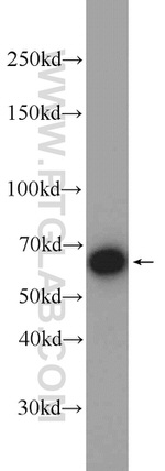 TRIM29 Antibody in Western Blot (WB)