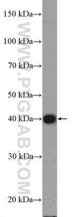 KLF17 Antibody in Western Blot (WB)