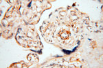 EHBP1 Antibody in Immunohistochemistry (Paraffin) (IHC (P))