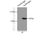 P5CS Antibody in Immunoprecipitation (IP)