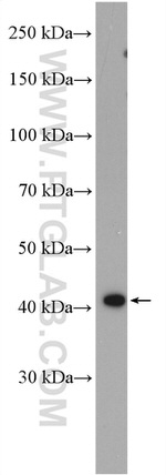 RRM2B/p53R2 Antibody in Western Blot (WB)