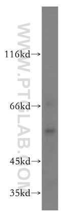 RAB11FIP2 Antibody in Western Blot (WB)