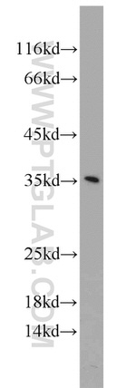 FGF5 Antibody in Western Blot (WB)