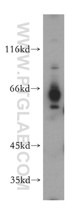 HEPACAM Antibody in Western Blot (WB)