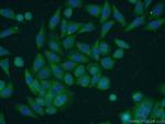 TBC1D22A Antibody in Immunocytochemistry (ICC/IF)