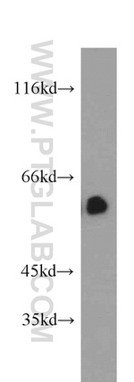 TBC1D22A Antibody in Western Blot (WB)