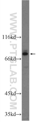 Cathepsin V Antibody in Western Blot (WB)