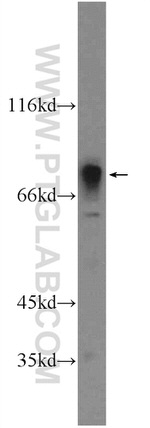 Cathepsin V Antibody in Western Blot (WB)