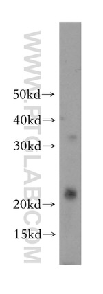 PPP1R14B Antibody in Western Blot (WB)