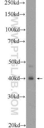 HOXA9 Antibody in Western Blot (WB)