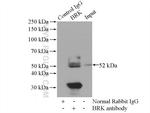 BRK Antibody in Immunoprecipitation (IP)