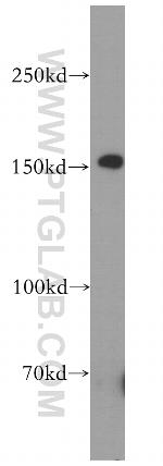 EPHA1 Antibody in Western Blot (WB)
