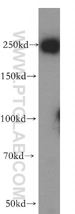 USP32 Antibody in Western Blot (WB)