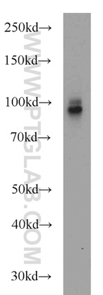 CD39/ENTPD1 Antibody in Western Blot (WB)