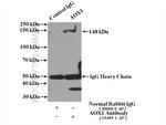 Aldehyde oxidase Antibody in Immunoprecipitation (IP)