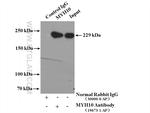 MYH10 Antibody in Immunoprecipitation (IP)