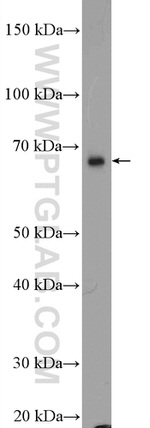 DHX32 Antibody in Western Blot (WB)