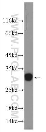 C11orf79 Antibody in Western Blot (WB)