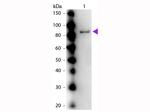 Urease Polyclonal Antibody