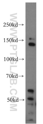 POLR2B Antibody in Western Blot (WB)