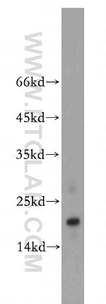 TMEM70 Antibody in Western Blot (WB)