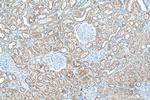 ZIP8 Antibody in Immunohistochemistry (Paraffin) (IHC (P))