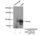 ZIP8 Antibody in Immunoprecipitation (IP)