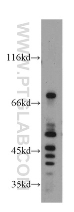 WIPF2 Antibody in Western Blot (WB)