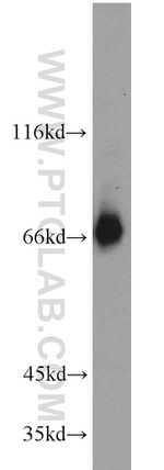 KIFC1 Antibody in Western Blot (WB)