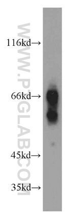 Caldesmon Antibody in Western Blot (WB)