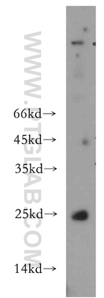 CHCHD4 Antibody in Western Blot (WB)