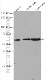 PPM2C Antibody in Western Blot (WB)
