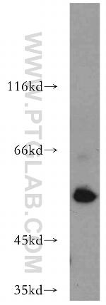 AAMP Antibody in Western Blot (WB)