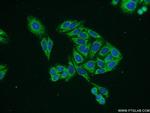 VANGL2 Antibody in Immunocytochemistry (ICC/IF)