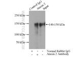 Ataxin 2 Antibody in Immunoprecipitation (IP)
