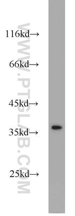TTF1/NKX2-1 Antibody in Western Blot (WB)