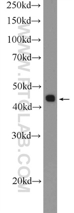 TTF1/NKX2-1 Antibody in Western Blot (WB)