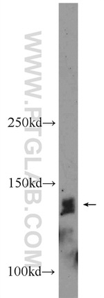 PHF20 Antibody in Western Blot (WB)