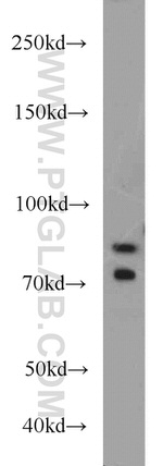iPLA2 Antibody in Western Blot (WB)