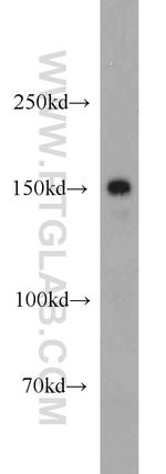 LTBP1 Antibody in Western Blot (WB)