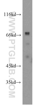 ATP1B2 Antibody in Western Blot (WB)