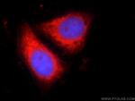 CNOT9 Antibody in Immunocytochemistry (ICC/IF)