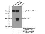CNOT9 Antibody in Immunoprecipitation (IP)