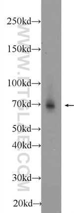 AIRE Antibody in Western Blot (WB)