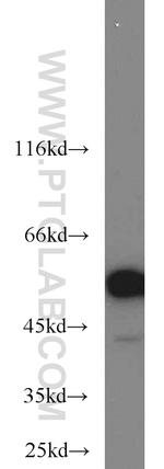 FKBP52 Antibody in Western Blot (WB)