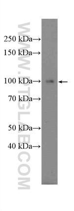 PDE5A Antibody in Western Blot (WB)